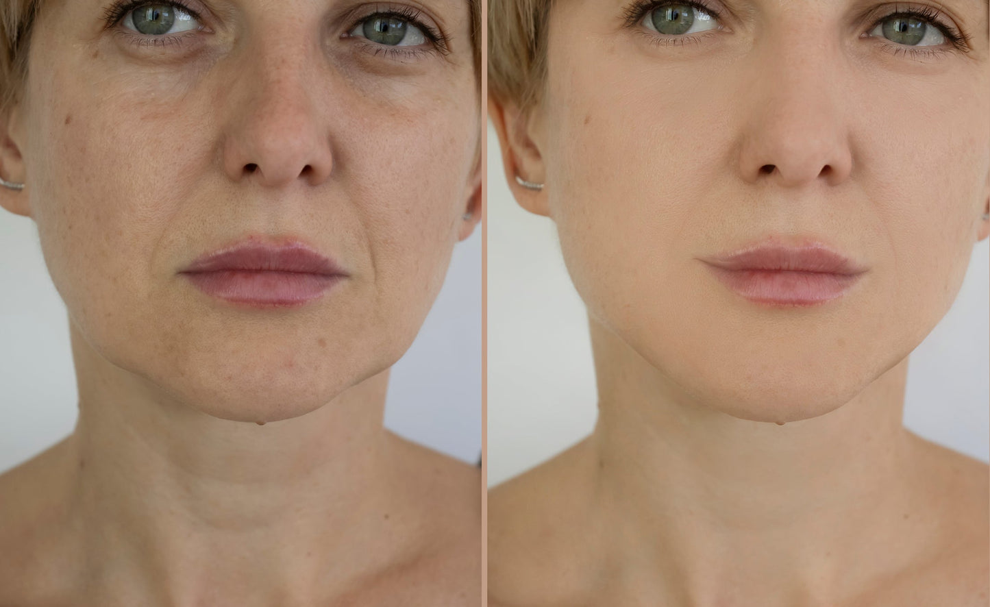 Bakuchiol Sérum imperfections Bakuchiol 3 % - 30 ml ola