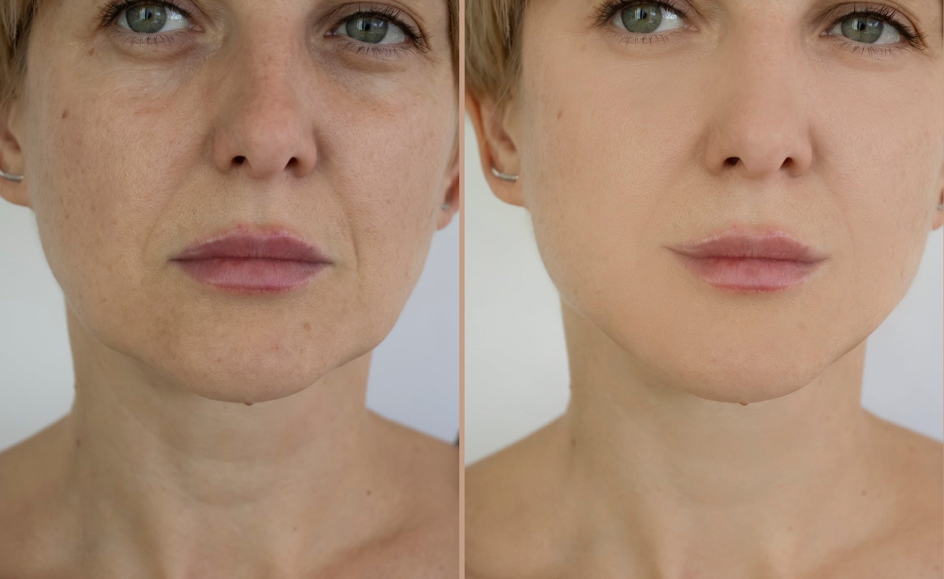 Bakuchiol Sérum imperfections Bakuchiol 3 % - 30 ml ola