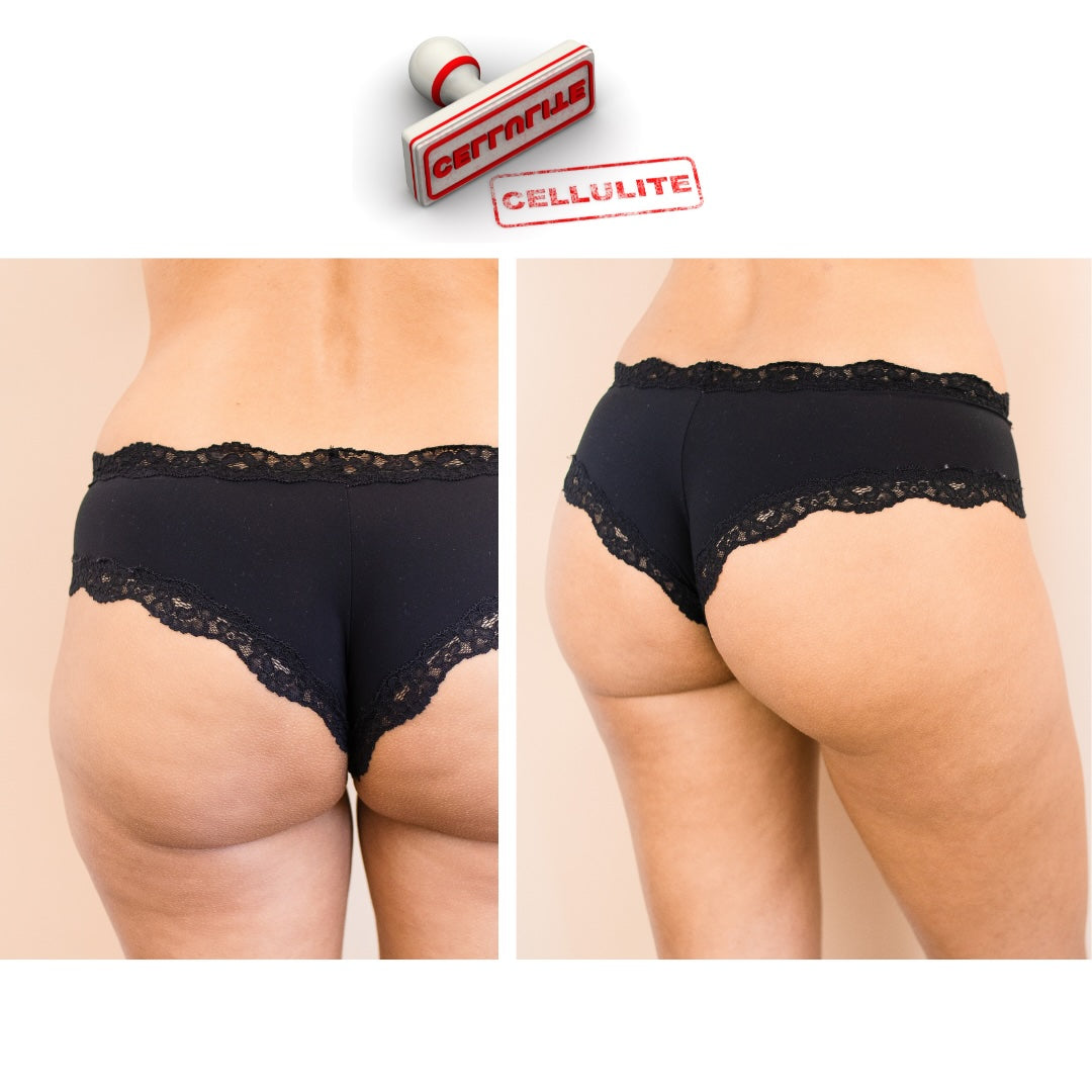Crème amincissante 264