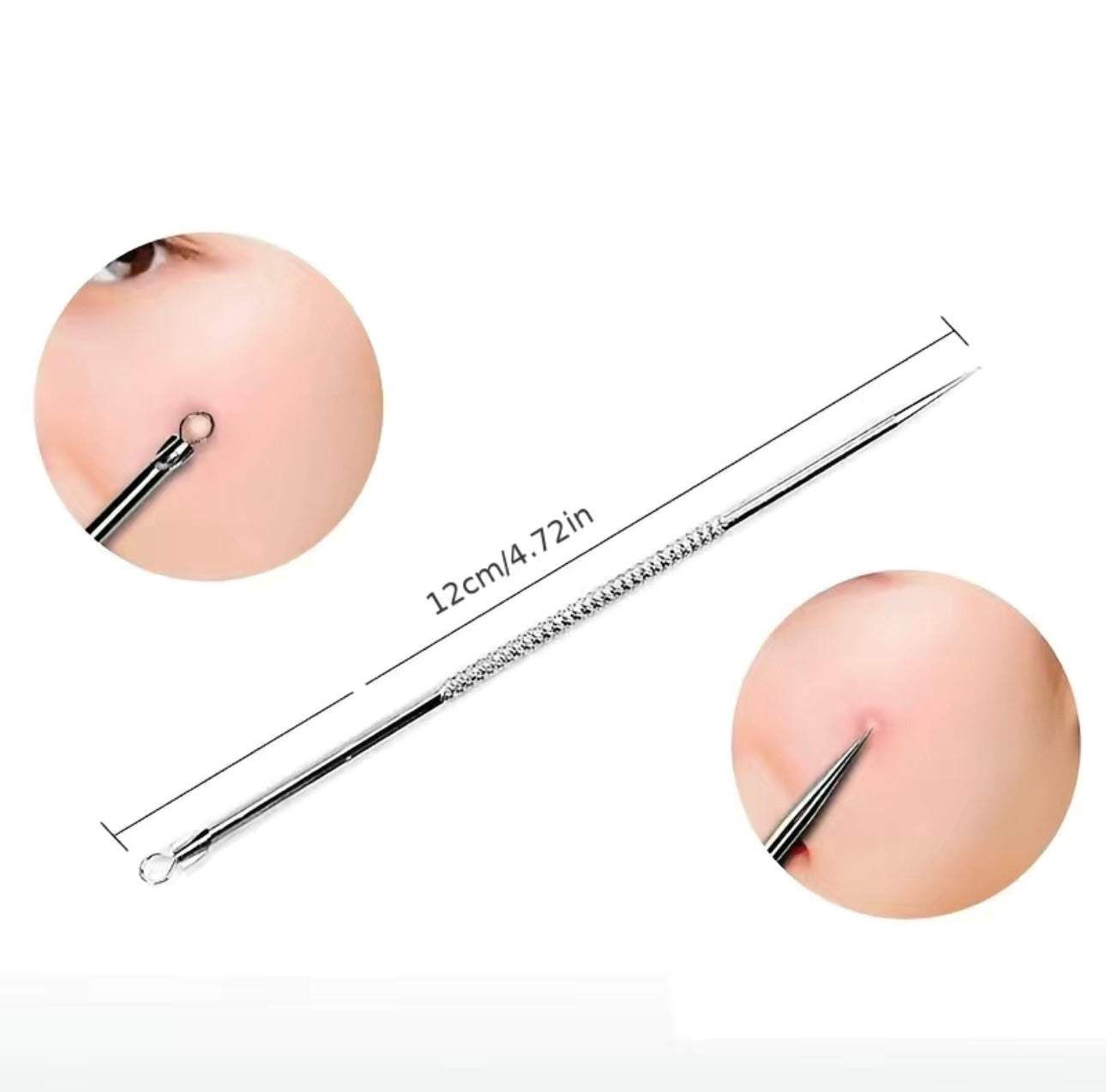 Kit de Suppression de points noirs