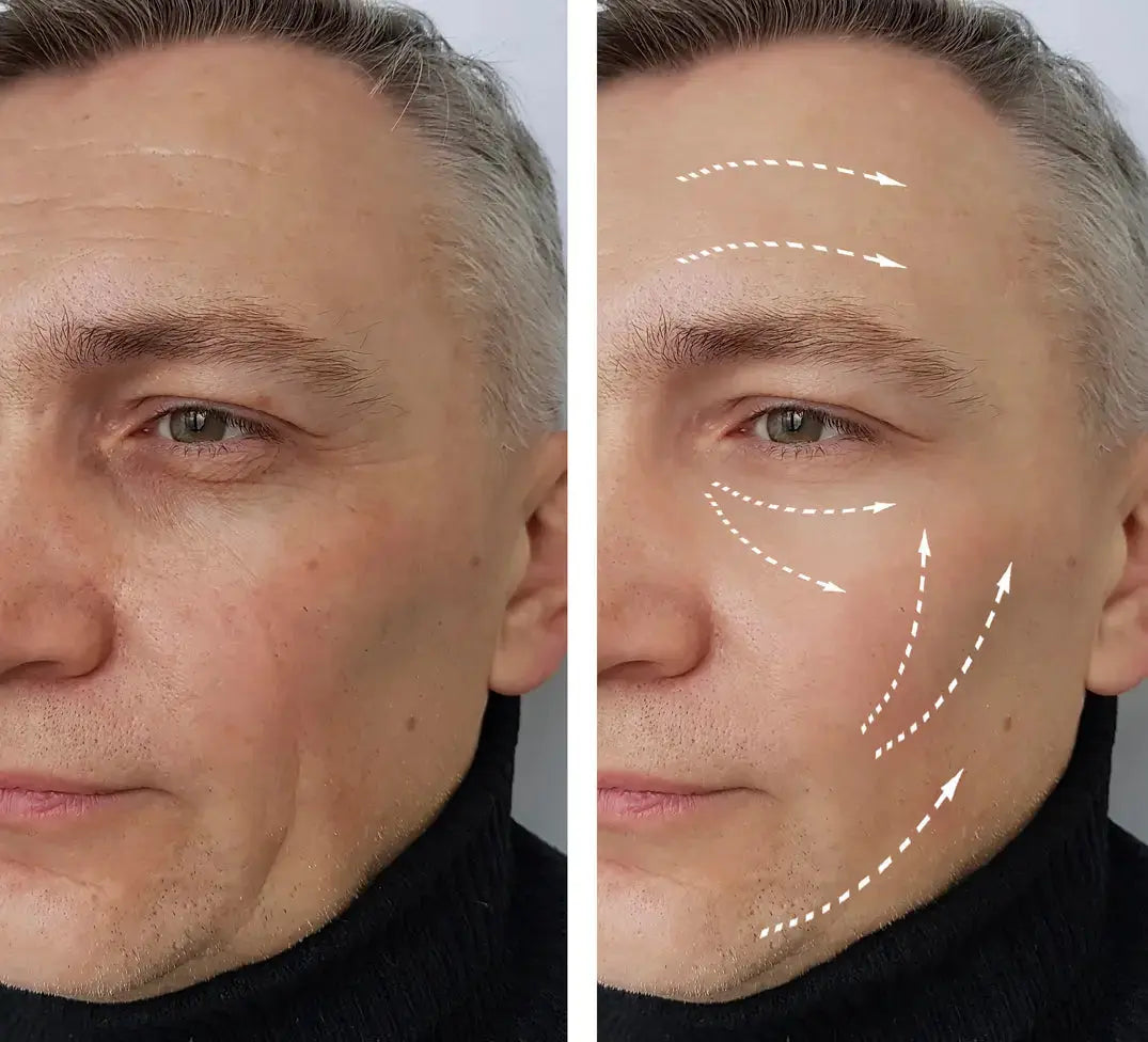 Face Roller 256