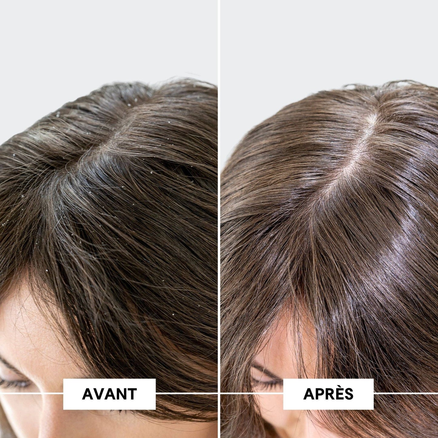 Shampooing Anti-Pelliculaire Anti-Démangeaisons 208